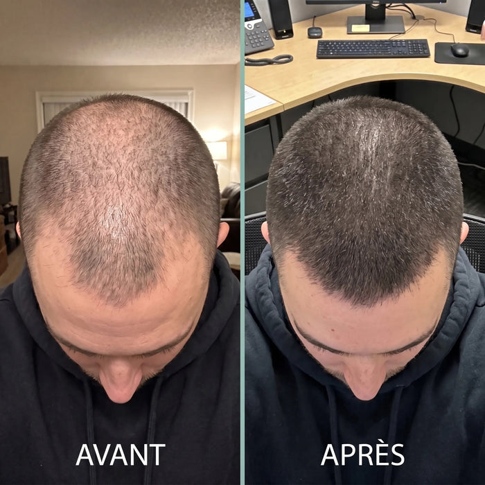 Avant après : crâne rasé