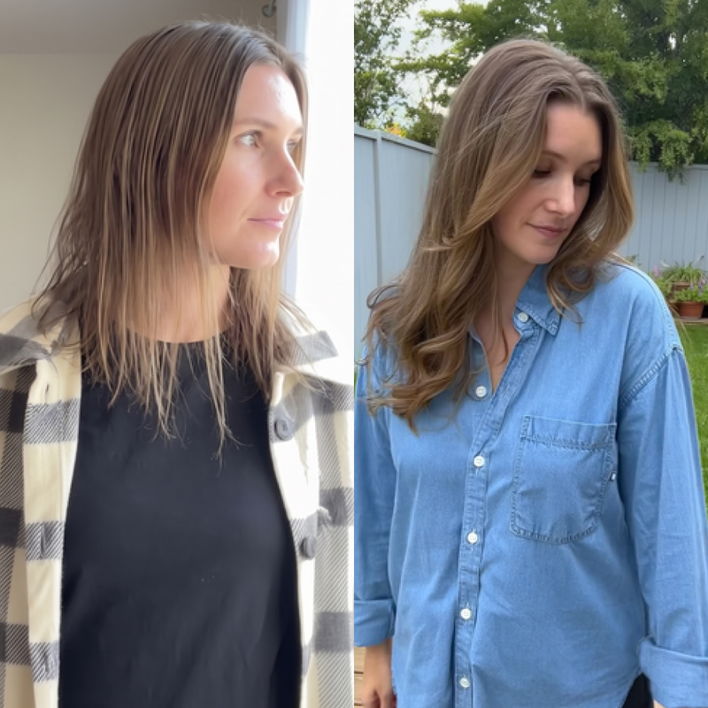 PROVISOIRE A REMPLACER - femme resultat avant apres raie